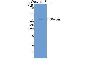 Western blot analysis of the recombinant protein. (SLC2A14 Antikörper  (AA 51-105))
