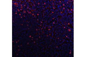 IF analysis of CD79b using anti-CD79b antibody (ABIN3043398). (CD79b Antikörper  (AA 29-229))