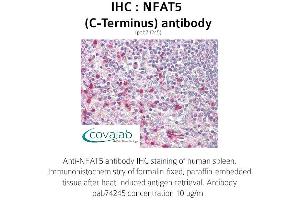 Image no. 1 for anti-Nuclear Factor of Activated T-Cells 5, Tonicity-Responsive (NFAT5) antibody (ABIN1737328) (NFAT5 Antikörper)