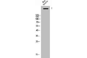 Western Blot analysis of Rat-brain cells using Phospho-IP3R-I (S1764) Polyclonal Antibody (ITPR1 Antikörper  (pSer1764))