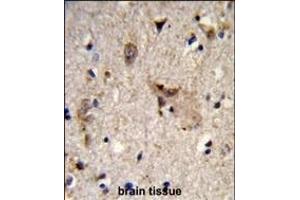 Formalin-fixed and paraffin-embedded human brain tissue reacted with ALDH18A1 Antibody (Center), which was peroxidase-conjugated to the secondary antibody, followed by DAB staining. (P5CS Antikörper  (AA 176-205))
