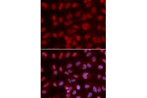 Immunofluorescence analysis of U2OS cell using SIN3A antibody. (SIN3A Antikörper  (AA 1-120))