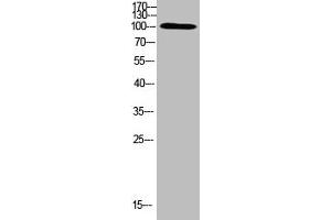 Western Blot analysis of HEPG2 cells using Antibody diluted at 500 (TRPV4 Antikörper  (AA 461-510))