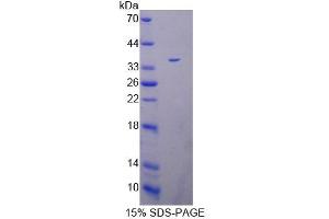 Image no. 1 for Peptidyl Arginine Deiminase, Type IV (PADI4) (AA 1-300) protein (His tag) (ABIN4990461)