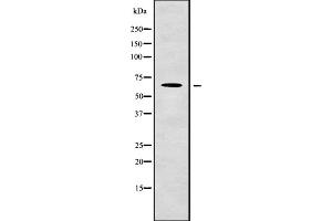 Western blot analysis of LINGO2 using COLO205 whole cell lysates (LINGO2 Antikörper  (Internal Region))