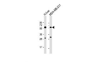 Western Blot at 1:8000 dilution Lane 1: human liver lysate Lane 2: MDA-MB-231 whole cell lysate Lysates/proteins at 20 ug per lane.