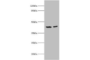 Western blot All lanes: Short-chain specific acyl-CoA dehydrogenase, mitochondrial antibody at 7 μg/mL Lane 1: 293T whole cell lysate Lane 2: HepG2 whole cell lysate Secondary Goat polyclonal to rabbit IgG at 1/10000 dilution Predicted band size: 44 kDa Observed band size: 44 kDa (ACADS Antikörper  (AA 1-260))