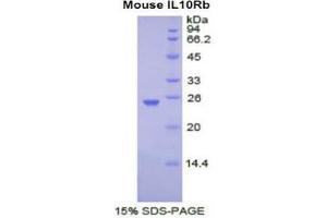 SDS-PAGE (SDS) image for Interleukin 10 Receptor, beta (IL10RB) (AA 42-218) protein (His tag) (ABIN2121385) (IL10RB Protein (AA 42-218) (His tag))