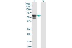 Western Blot analysis of CHST12 expression in transfected 293T cell line by CHST12 monoclonal antibody (M01), clone 3D6. (CHST12 Antikörper  (AA 56-150))