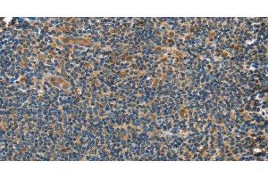 Immunohistochemistry of paraffin-embedded Human tonsil tissue using GRB7 Polyclonal Antibody at dilution 1:40
