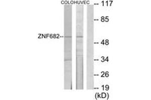 Western blot analysis of extracts from COLO205/HuvEc cells, using ZNF682 Antibody. (ZNF682 Antikörper  (AA 21-70))