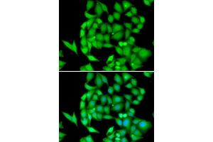 Immunofluorescence analysis of HeLa cells using NEK3 antibody. (NEK3 Antikörper  (AA 267-506))