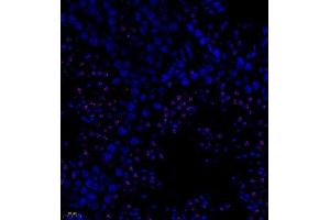 Immunofluorescence of paraffin embedded mouse testis using PTPN2 (ABIN7075295) at dilution of 1:500 (400x lens)