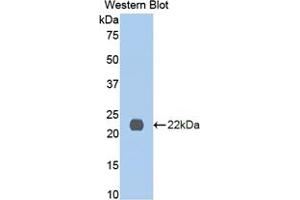 Western blot analysis of the recombinant protein. (IL13 Receptor alpha 1 Antikörper  (AA 201-360))