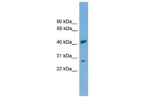 Western Blot showing SLC25A37 antibody used at a concentration of 1-2 ug/ml to detect its target protein.