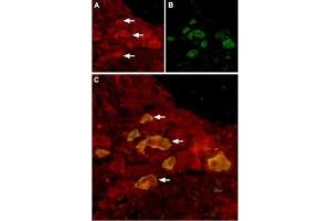 Expression of TRPV6 in rat DRG - Immunohistochemical staining of rat dorsal root ganglion (DRG) using Anti-TRPV6 Antibody (ABIN7043857, ABIN7043998 and ABIN7043999), (1:100). (TRPV6 Antikörper  (C-Term, Intracellular))