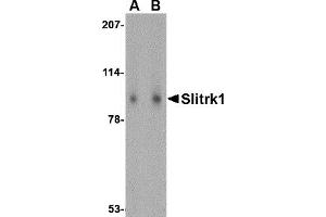 Western Blotting (WB) image for anti-SLIT and NTRK-Like Family, Member 1 (SLITRK1) (Middle Region) antibody (ABIN1031098) (SLITRK1 Antikörper  (Middle Region))