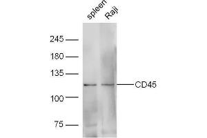 Lane 1: Mouse spleen lysates; Lane 2: Human raji lysates probed with Rabbit Anti-CD45 Polyclonal Antibody, Unconjugated  at 1:5000 for 90 min at 37˚C.