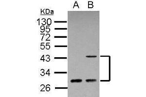 WB Image Sample (30 ug of whole cell lysate) A: A431 B: HeLa 12% SDS PAGE antibody diluted at 1:500 (ING1 Antikörper  (C-Term))