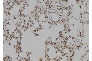 ABIN6277041 at 1/100 staining Rat lung tissue by IHC-P. (LHX8 Antikörper  (Internal Region))
