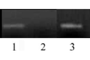 Histone H3 monomethyl Lys4 antibody (mAb) tested by ChIP.