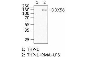 Western Blotting (WB) image for anti-DEAD (Asp-Glu-Ala-Asp) Box Polypeptide 58 (DDX58) antibody (ABIN2664928) (DDX58 Antikörper)