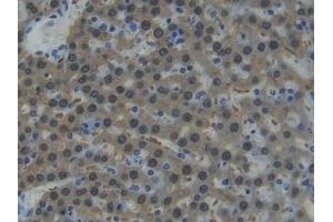 Detection of AST in Rat Liver Tissue using Polyclonal Antibody to Aspartate Aminotransferase (AST) (GOT1 Antikörper  (AA 1-413))