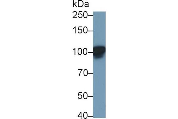 Leptin Receptor Antikörper  (AA 22-203)