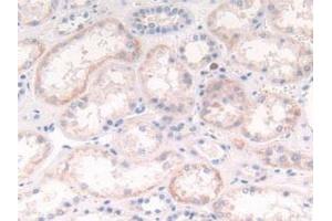 Detection of CTSG in Human Kidney Tissue using Polyclonal Antibody to Cathepsin G (CTSG) (Cathepsin G Antikörper  (AA 21-255))