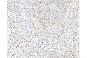 Immunohistochemistry (IHC) image for anti-CCCTC-Binding Factor (Zinc Finger Protein) (CTCF) (AA 650-700) antibody (ABIN7453967) (Rekombinanter CTCF Antikörper  (AA 650-700))