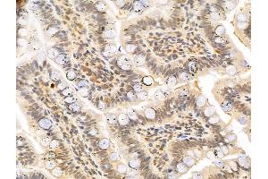 ABIN6263157 and ABIN6273006 at 1/100 staining Rat colon tissue by IHC-P. (MCM10 Antikörper  (C-Term))