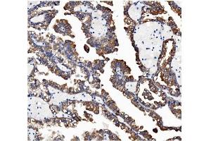 IHC analysis of VAPB using anti-VAPB antibody (ABIN5693292). (VAPB Antikörper  (AA 2-55))