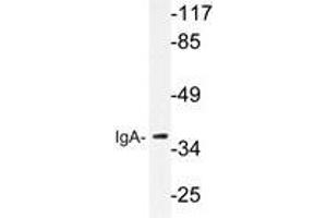 Western blot analysis of IgA antibody in extracts from HeLa cells. (Kaninchen anti-Human IgA Antikörper)