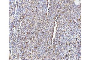 IHC analysis of IL-17A/Il17a using anti-IL-17A/Il17a antibody (ABIN7600319).