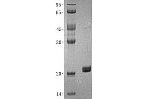 Western Blotting (WB) image for Hippocalcin-Like 1 (HPCAL1) (Transcript Variant 1) protein (His tag) (ABIN2722769)