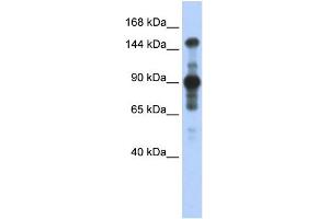 WB Suggested Anti-MINK1 Antibody Titration:  0. (MAP4K6 Antikörper  (Middle Region))