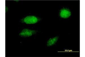 Immunofluorescence of monoclonal antibody to FOXC2 on HeLa cell. (FOXC2 Antikörper  (AA 421-501))