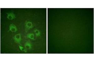 Immunofluorescence analysis of HuvEc cells, using CrkL (Phospho-Tyr207) Antibody. (CrkL Antikörper  (pTyr207))