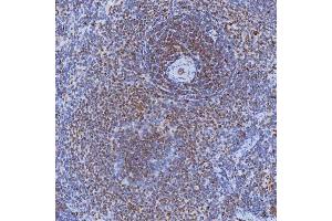 IHC analysis of TRMT61A using anti-TRMT61A antibody (ABIN7599220).