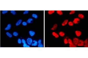 Immunofluorescence analysis of 293T cells using DiMethyl-Histone H3-K27 Polyclonal Antibody (Histone 3 Antikörper  (2meLys27))