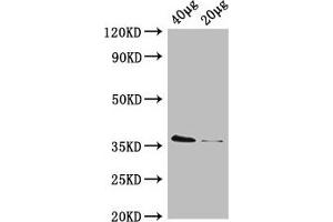 Western Blot Positive WB detected in: Rosseta bacteria lysate at 40 μg, 20 μg All lanes: dcyD antibody, HRP conjugated at 0. (DcyD Antikörper  (AA 2-328) (HRP))