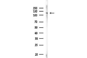 Western blot analysis of lysates from MC-3T3-E1 cells, using Phospho-mGluR5 (Ser870) Antibody at 1/1000 dilution.
