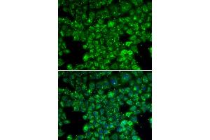 Immunofluorescence analysis of U2OS cells using LYZL6 antibody. (LYZL6 Antikörper)