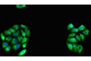 Immunofluorescent analysis of PC-3 cells using ABIN7146203 at dilution of 1:100 and Alexa Fluor 488-congugated AffiniPure Goat Anti-Rabbit IgG(H+L) (OB Cadherin Antikörper  (AA 637-796))