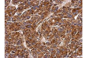 Immunohistochemistry (IHC) image for anti-Methylmalonic Aciduria (Cobalamin Deficiency) CblB Type (MMAB) (Center) antibody (ABIN2856429)