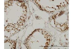 Immunostaining (ISt) image for anti-TAF1 RNA Polymerase II, TATA Box Binding Protein (TBP)-Associated Factor, 210kDa-Like (TAF1L) (AA 1532-1641) antibody (ABIN566824)