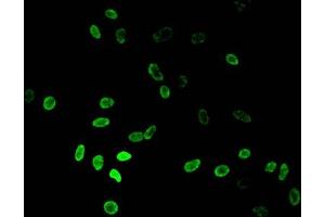 Immunofluorescence (IF) image for anti-Histone Cluster 1, H3a (HIST1H3A) (2meLys36) antibody (ABIN7139276)