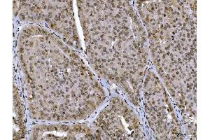 IHC analysis of CTBP2 using anti-CTBP2 antibody (ABIN7601326). (CTBP2 Antikörper  (AA 321-445))