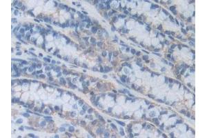 IHC-P analysis of Mouse Small intestine Tissue, with DAB staining. (HPSE Antikörper  (AA 353-464))