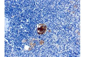 Formalin-fixed, paraffin-embedded human Spleen stained with TRAcP Monoclonal Antibody (SPM601). (ACP5 Antikörper)